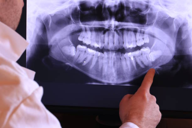 Best After-Hours Emergency Dentist in Borden, IN